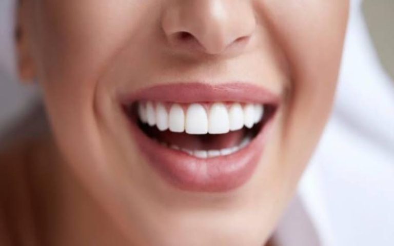 Transforming Smiles