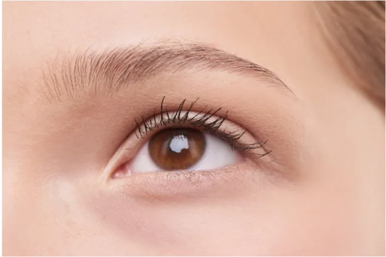 Double Eyelid Surgery