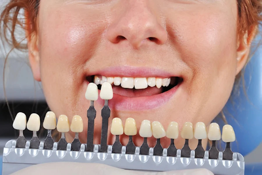 Everything You Need to Know Before Getting a Dental Crown Abroad